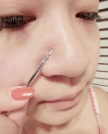 鼻子上挤出来“白色小颗粒”是什么?