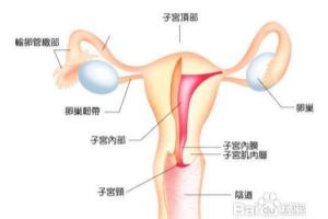 输卵管积液怎么办.
