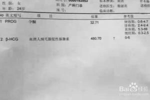 HCG检查是什么？为什么要抽血做好几次HCG检查？.