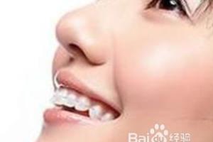 牙齿矫正有哪些注意事项.