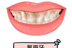牙齿问题类型图片.