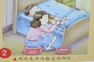 腿扭伤后的医疗保健.