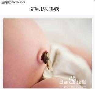 如何护理新生儿的肚脐?