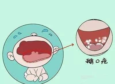 哺乳时纠正哺乳姿势后,乳头仍然疼痛应该怎么办