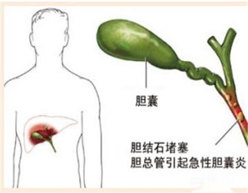 口气重怎么?