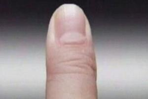 如何知道自己贫血.