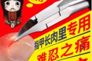 指甲长肉里可以怎么办？.
