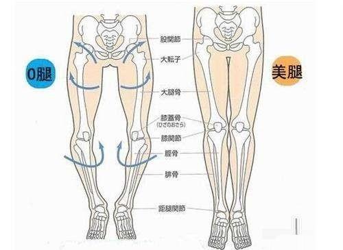 如何辨别自己的腿型?