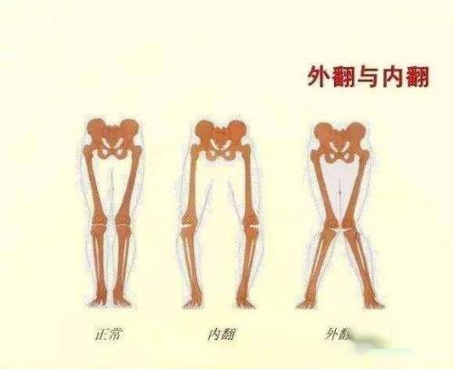 如何辨别自己的腿型?