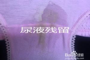 内裤发黄有危害 女性内裤发黄四大原因.
