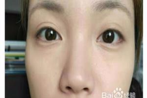 怎么化妆可以遮眼袋？.