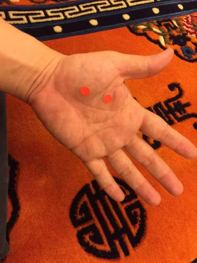 左肩膀后面肩胛骨缝隙处疼痛怎么办(2)