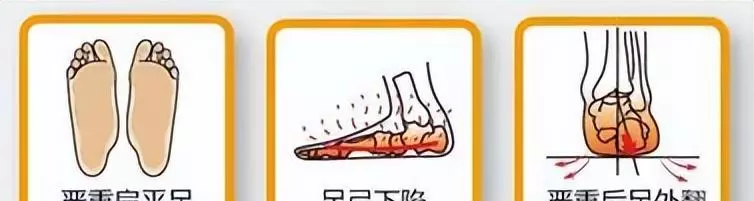 女生当兵的条件和要求2023(14)