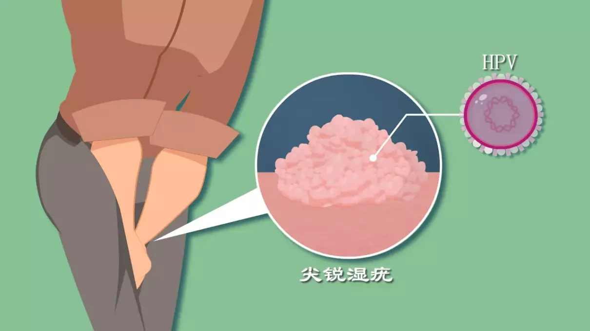 女生那里长了一个疙瘩是怎么回事(7)