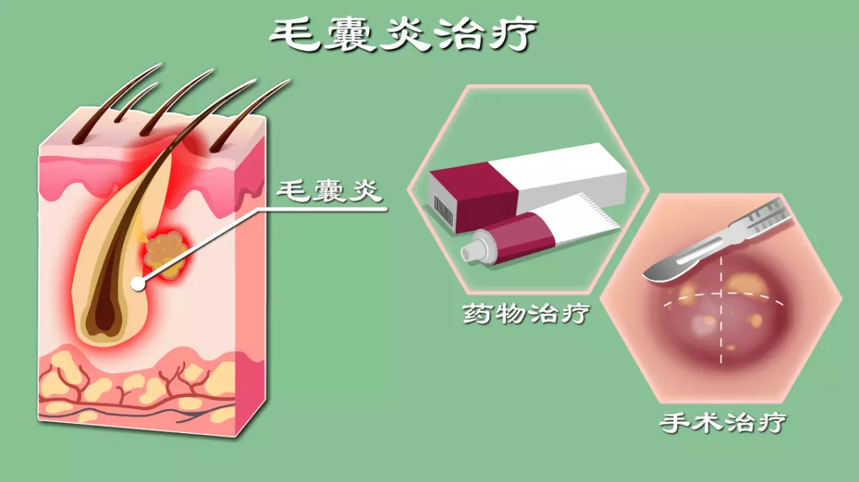 女生那里长了一个疙瘩是怎么回事(8)