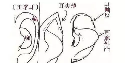 相面术中的耳朵相法(2)