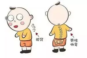 背背佳矫正脊柱侧弯有效果吗(2)