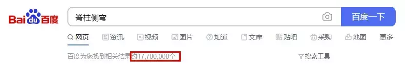 背背佳矫正脊柱侧弯有效果吗(4)