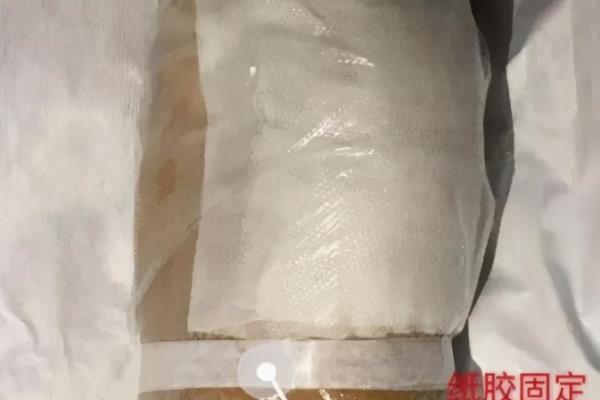 输液手肿了怎样快速消肿 土豆片.