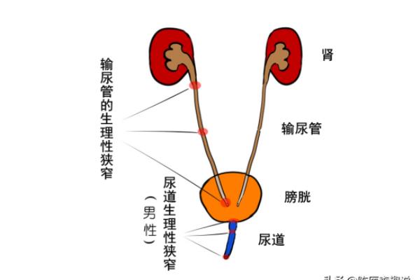输尿管结石0.8cm能排出来吗.