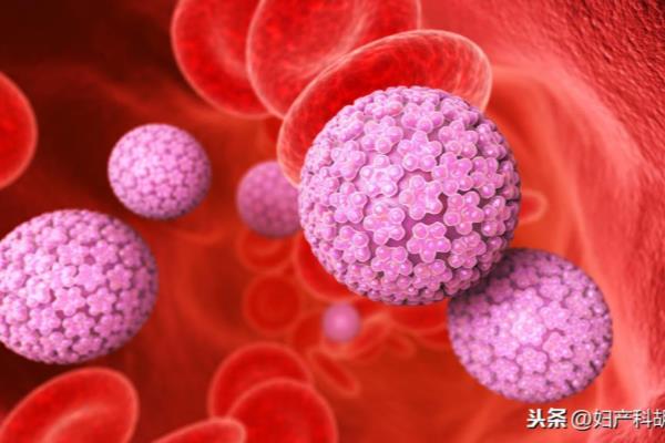 hpv病毒是存在局部还是全身.