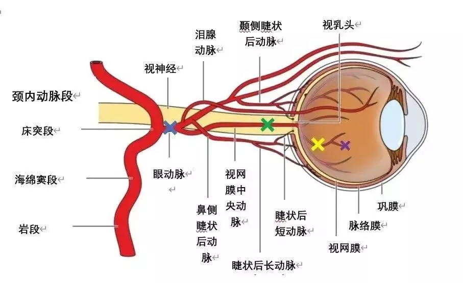 突然看不见了是怎么回事(3)