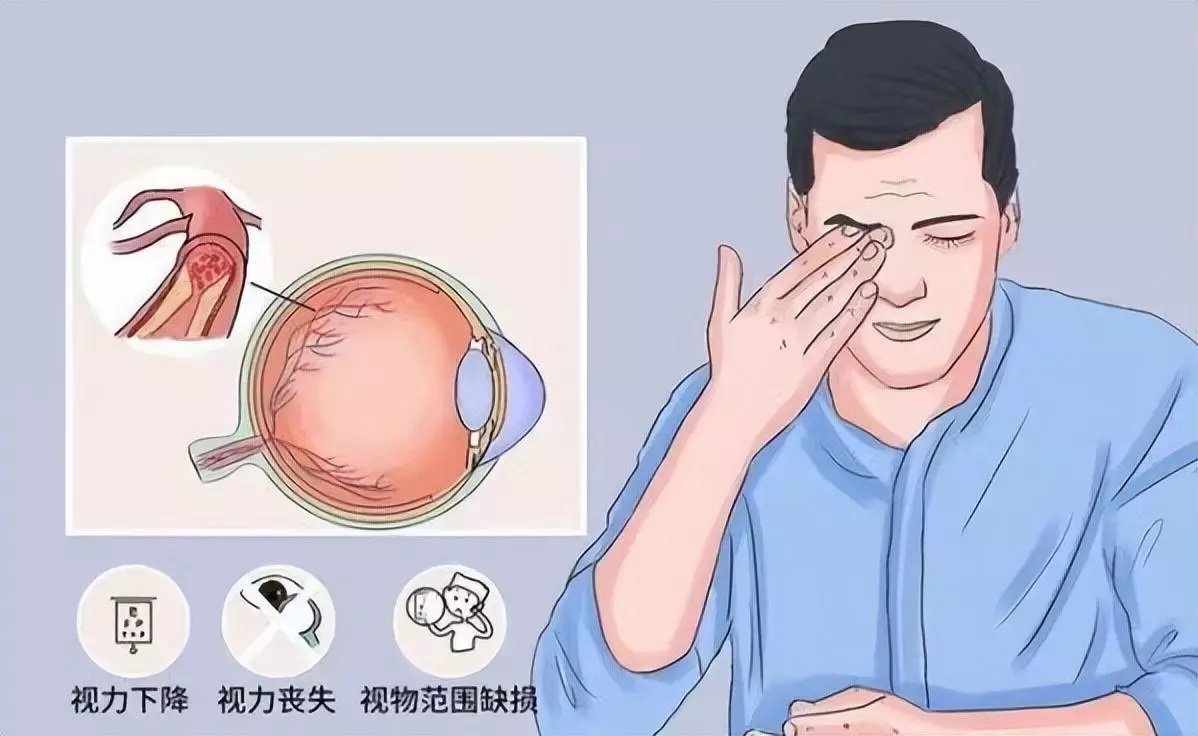 突然看不见了是怎么回事(4)