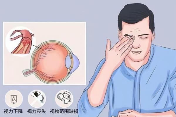 突然看不见了是怎么回事.