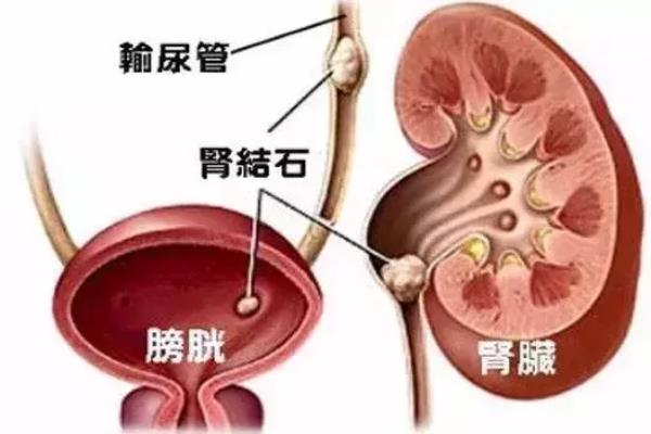 男性引起小腹痛的原因有哪些.