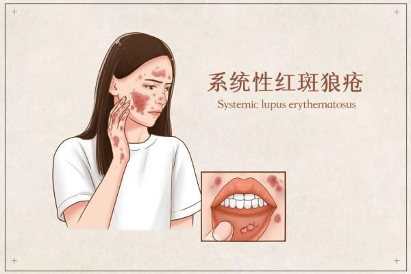 肠子全部烂是怎么引起的.