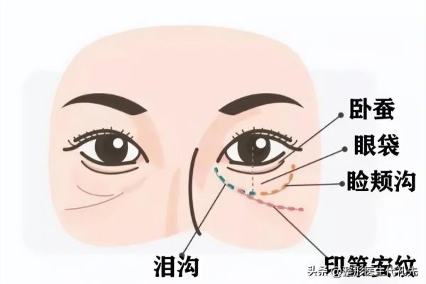 脸上有印第安纹需要怎么样解决.